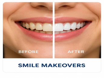 smile makeovers